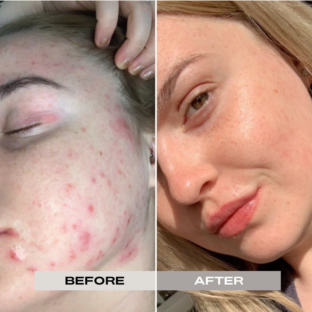 BRITISH PINK CLAY MASK & ILLUMINATING MASK OIL SET