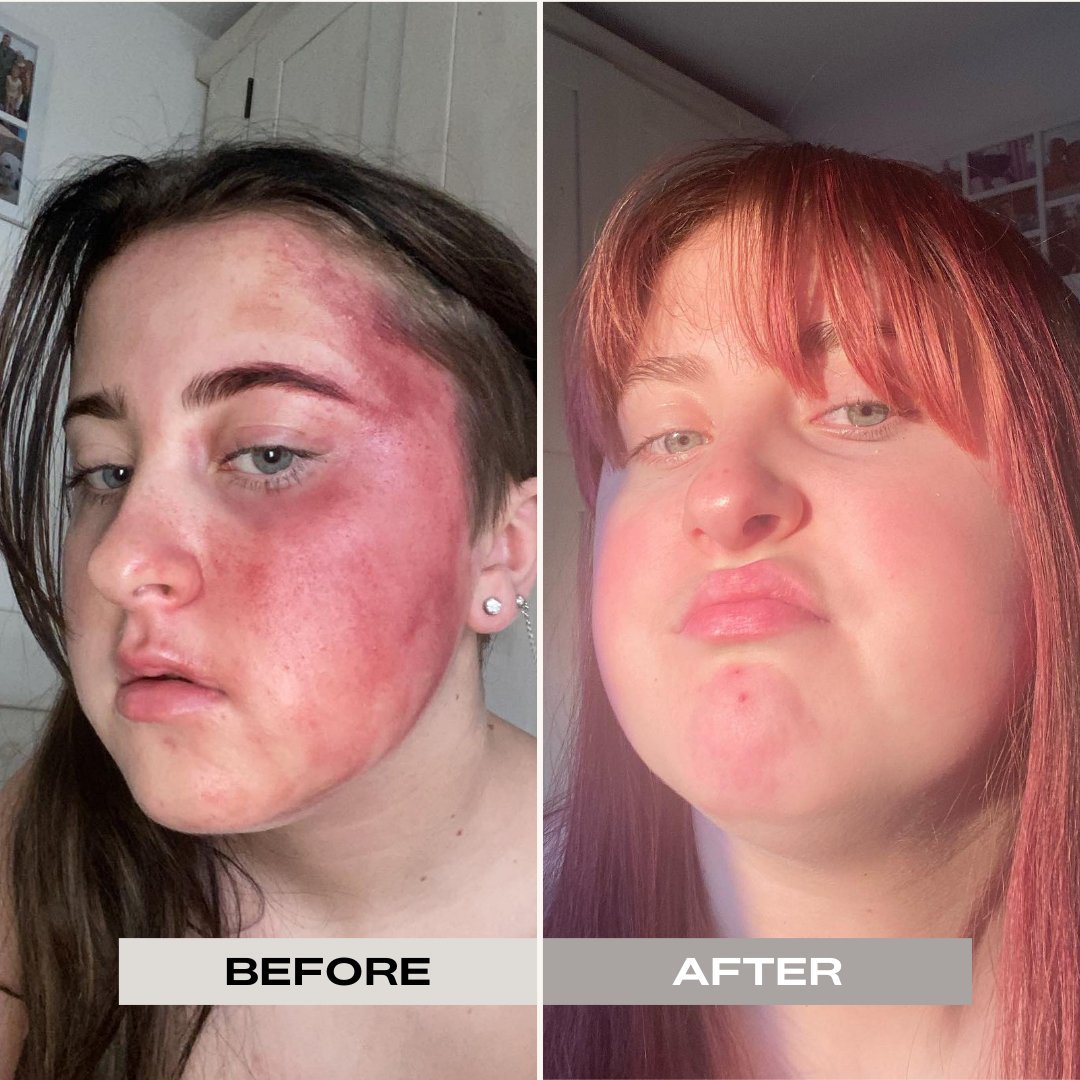 RADIANCE FACIAL OIL