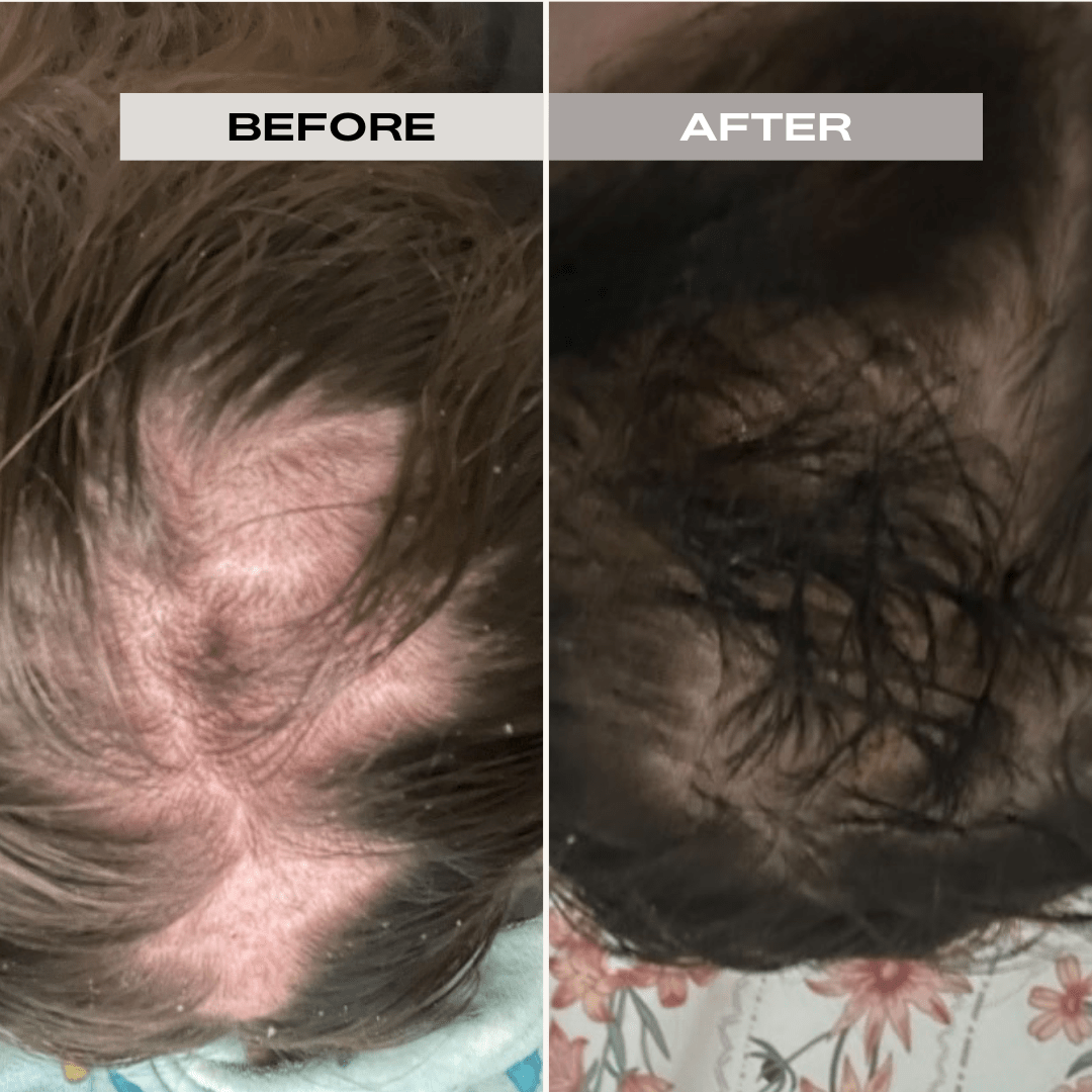 STIMULATING HAIR OIL